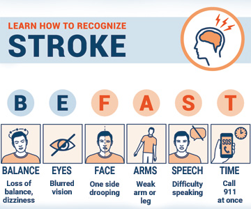 Be FAST stroke symptoms