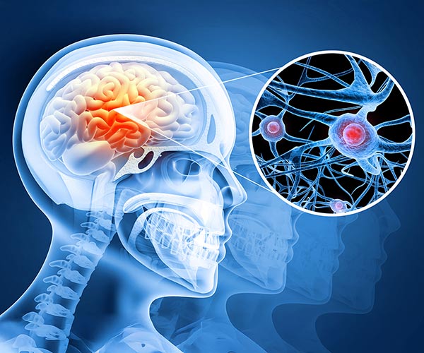 Colorful graphic showing the brain inside of a skeletal image and a cut out close up of a synapse connection.