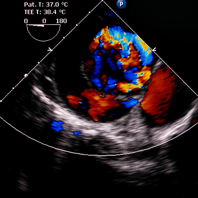 Colorful echocardiogram image