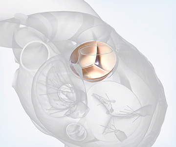 Illustration of an aortic valve, one of four heart valves and the final one encountered by oxygenated blood as it leaves the heart.