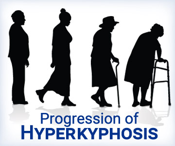 A silhouette of a woman in fours stages of life as her posture slowly goes from upright to hunched over due to the medical condition called hyperkyphosis.