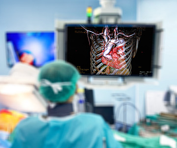 Blurry close up of surgeon looking at monitor showing heart valve during a minimally invasive surgery